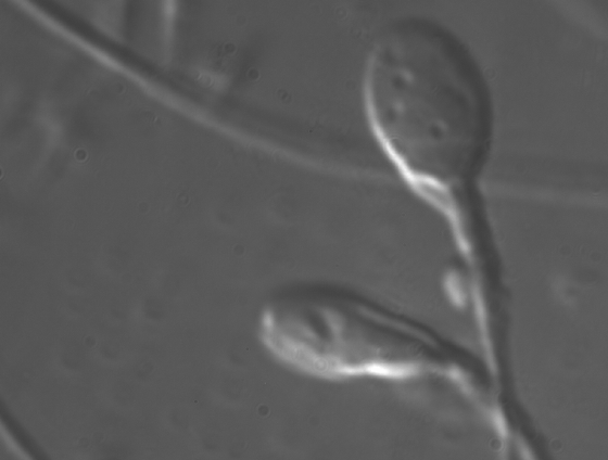 spermimage